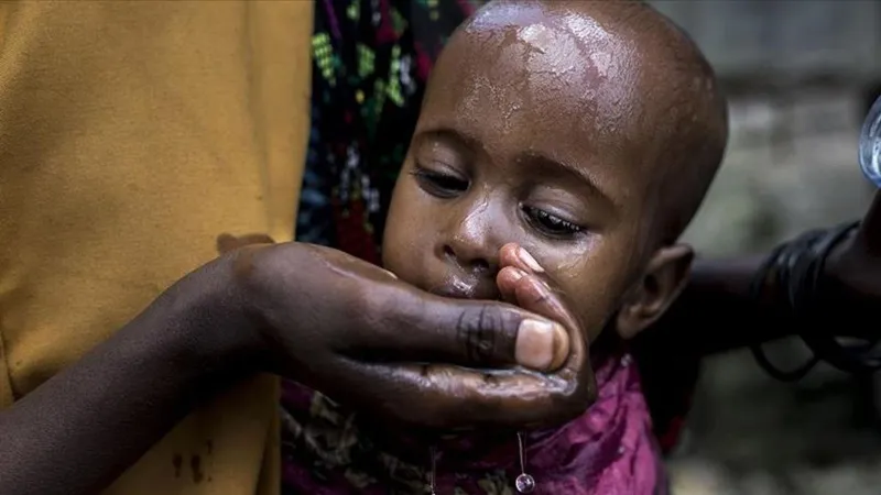 UNICEF acı tabloyu açıkladı: 1 milyondan fazla çocuk kolera riski altında